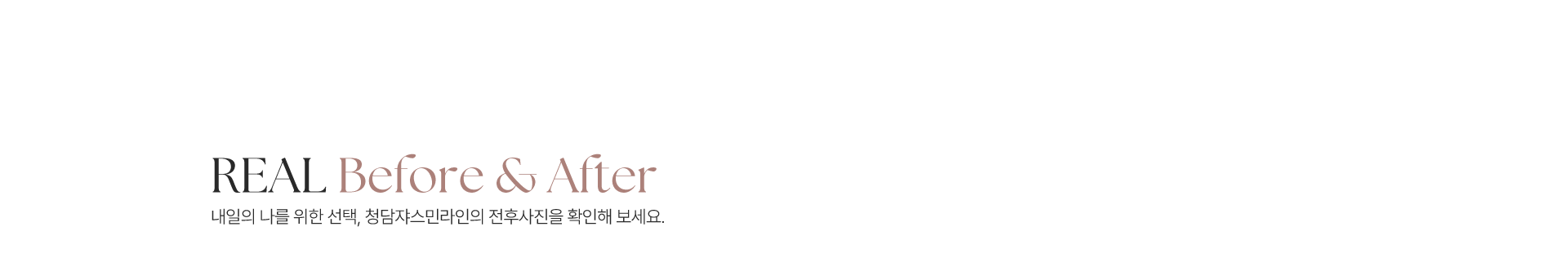 청담쟈스민라인의원 전후사진