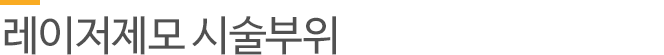 레이저제모 시술부위