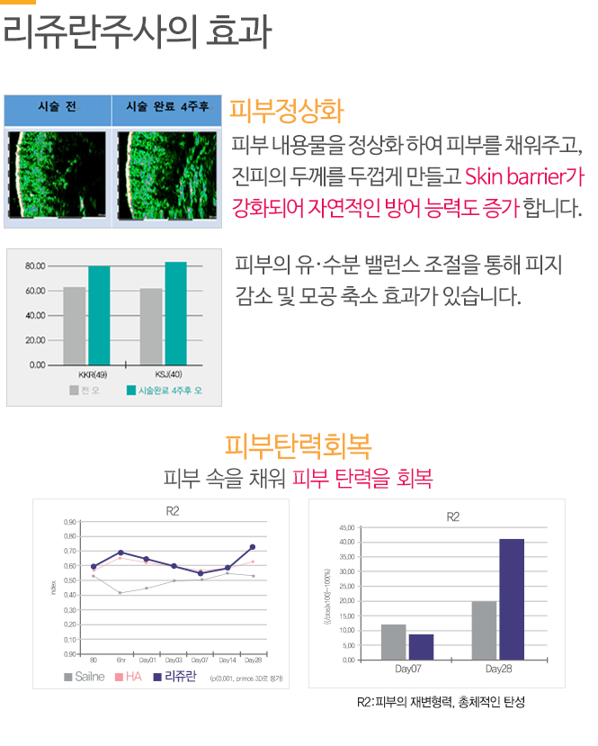 리쥬란힐러주사의 효과