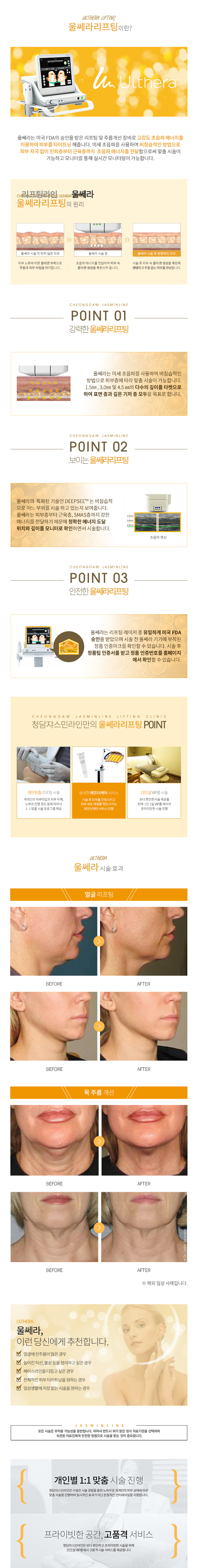 울쎄라
