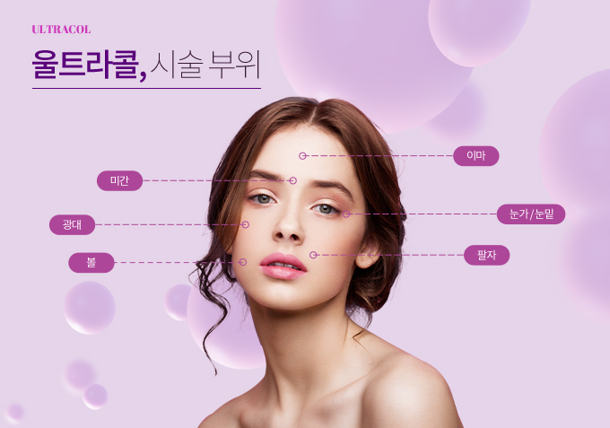 울트라콜