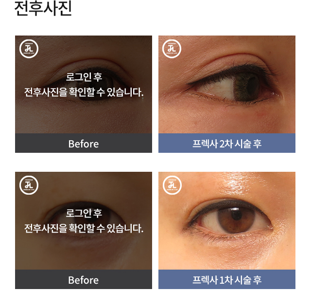 프렉사 로그인 전