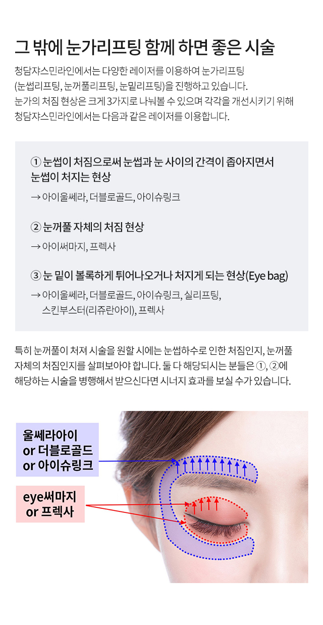 프렉사