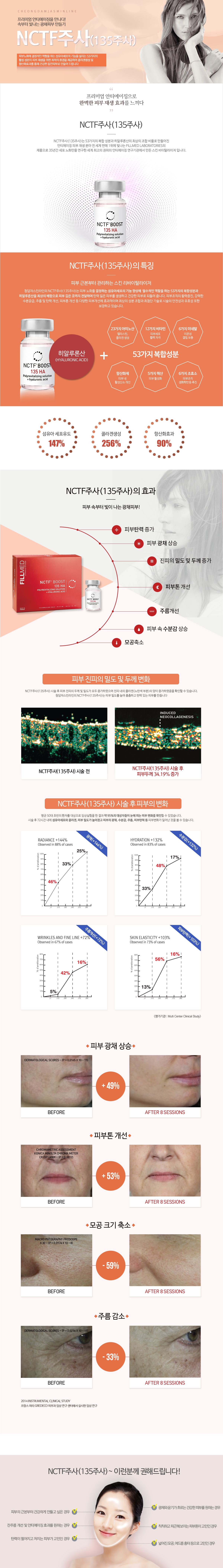 nctf주사