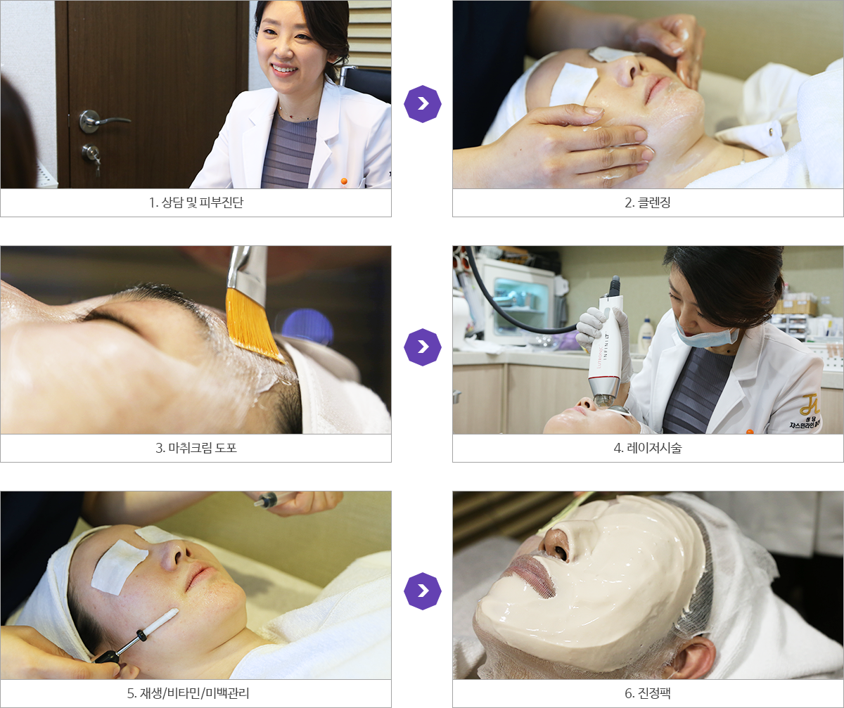 시술과정