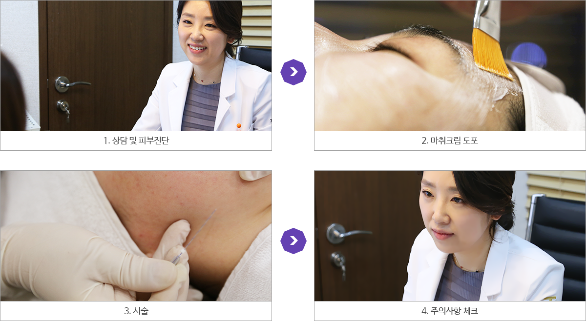 시술과정