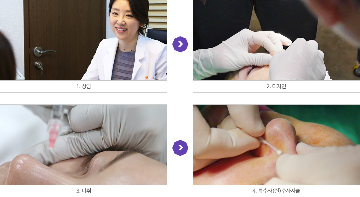 시술과정