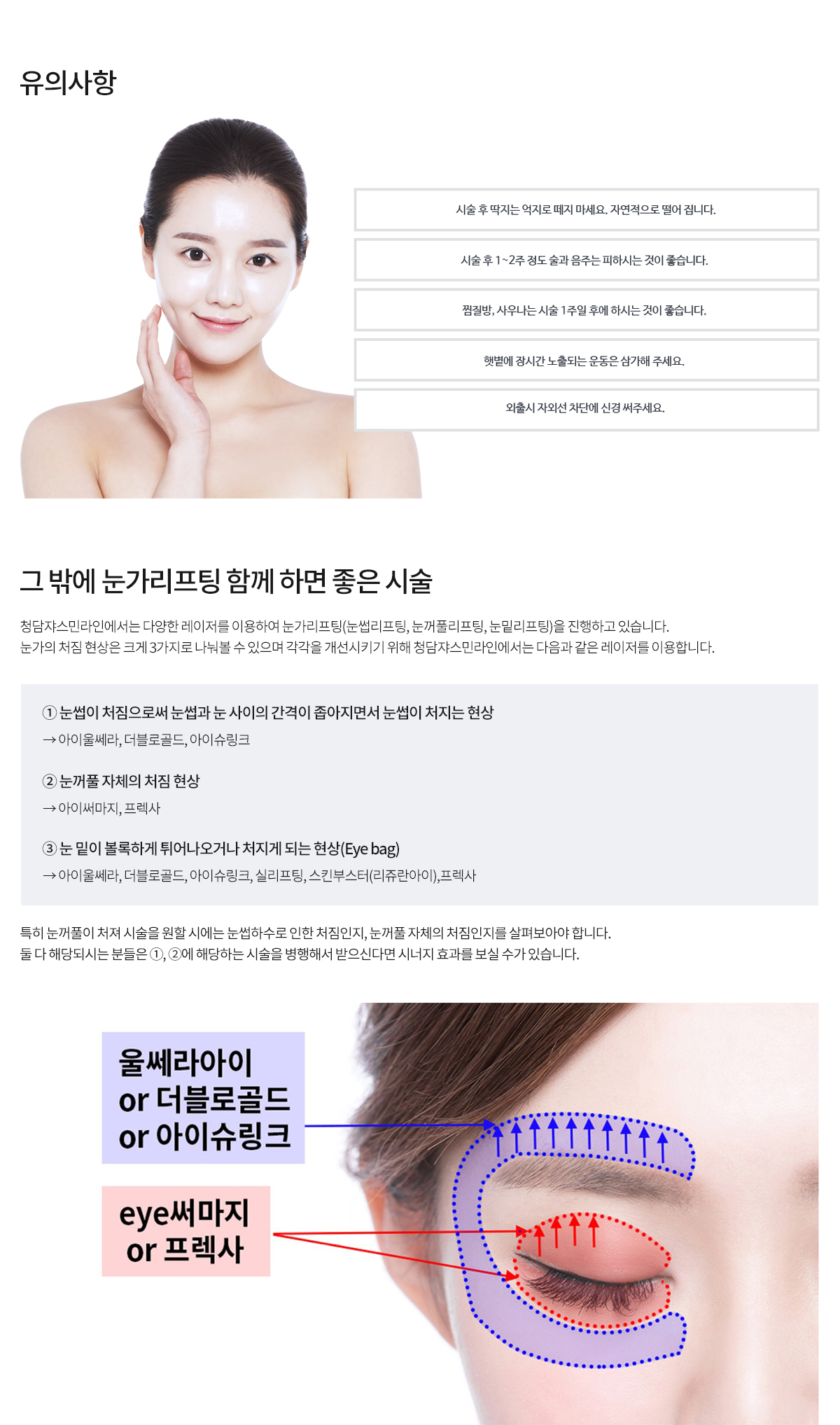 프렉사