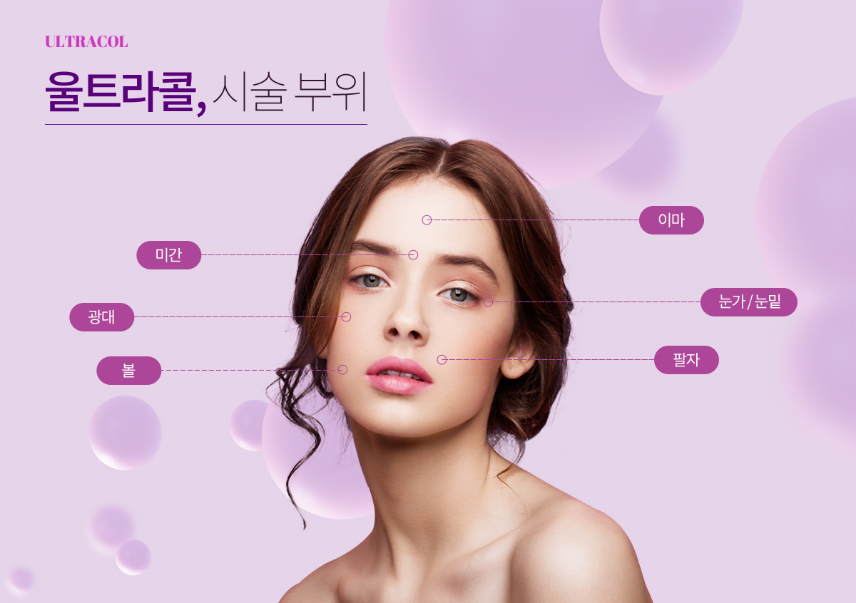 울트라콜