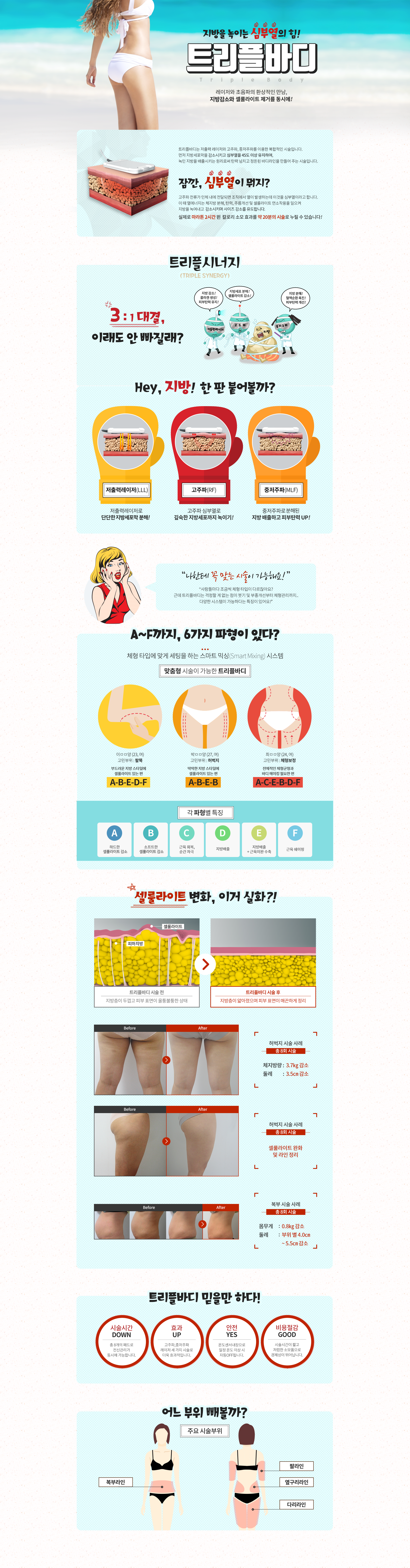 트리플바디